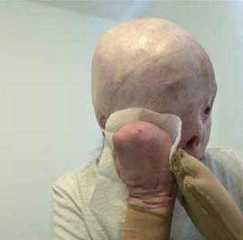 photo